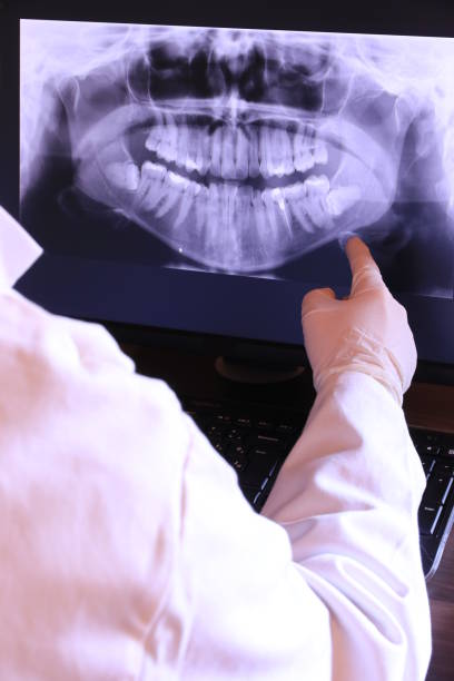 Best Emergency Dentist for Knocked-Out Tooth in Winchester, VA