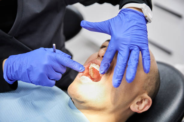 Best Emergency Dentist for Knocked-Out Tooth in Winchester, VA