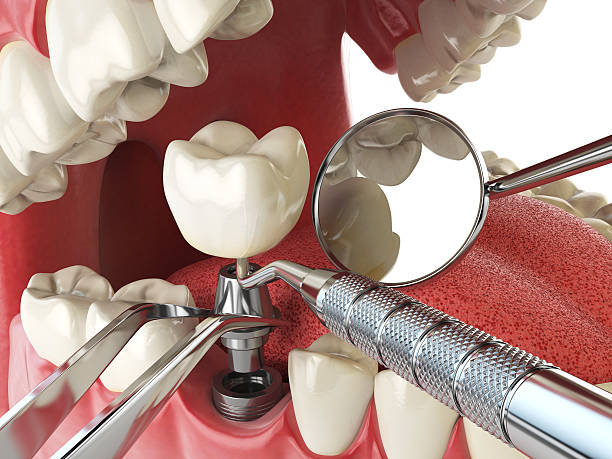 Best Mobile Emergency Dentist in Winchester, VA